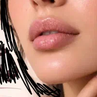 مدل جهت تزریق فیلر لب توسط پزشک پر سابقه