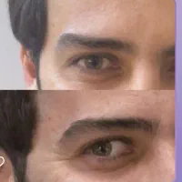 خدمات تخصصی تزریق بوتاکس فیلر بانوان و آقایون|خدمات آرایشگری و زیبایی|بیرجند, |دیوار