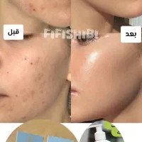 تنها نمایندگی سرم مغذی (همه کاره) لاکچری کوین|حراج|مشهد, فردوسی|دیوار