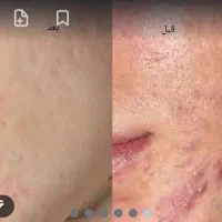 مشاوره وهمکاری|فعالیت داوطلبانه|مشهد, شهید فرامرز عباسی|دیوار
