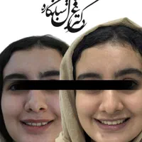ارتودنسی ثابت،متحرک،نامرئی کامپوزیت زیبایی|خدمات آرایشگری و زیبایی|تهران, دزاشیب|دیوار