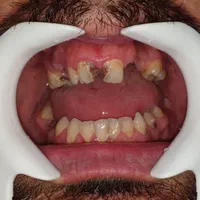 خدمات دندانپزشکی برلیان|خدمات آرایشگری و زیبایی|بانه, |دیوار