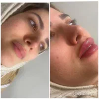کلینیک پوست مو و زیبایی آراد سهروردی شمالی|خدمات آرایشگری و زیبایی|تهران, سهروردی|دیوار
