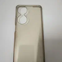 گوشی ردمی هونور x7b|موبایل|آزادشهر, |دیوار