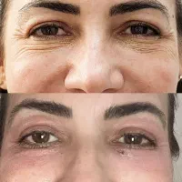 کلینیک زیبایی، جشنواره پاییزه تا ۵۰ درصد تخفیف