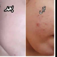 کرم اماراتی اصل  به صورت تک وعمده