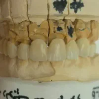 جذب نیروی کارآموز در لابراتوار دندانسازی