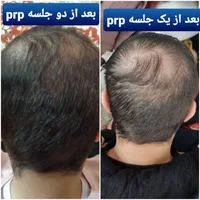 جشنواره کلینیک زیبایی تزریق فیلر، بوتاکس توسط پزشک|خدمات آرایشگری و زیبایی|نجف‌آباد, |دیوار