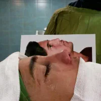 عمل بینی فقط با 30 ملیون|خدمات آرایشگری و زیبایی|شیراز, قصرالدشت|دیوار