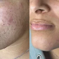 جشنواره پاکسازی پوست