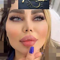 تزریق ژل وبوتاکس ومادلینگ اروپایی وهایفو درکلینیک|خدمات آرایشگری و زیبایی|کرمانشاه, |دیوار