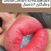آموزش وخدمات تاتو صورت .میکرو . ریمور .مزوتراپی|خدمات آرایشگری و زیبایی|اهواز, کیانشهر|دیوار