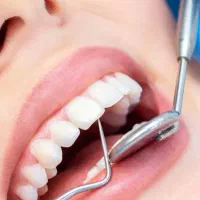 عصب کشی دندان قدامی و ۴و۵ پایین با کمترین هزینه