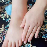 کرم سفیدکننده(آنتی استاین) ترکیب آمپولی|آرایشی، بهداشتی، درمانی|بم, |دیوار