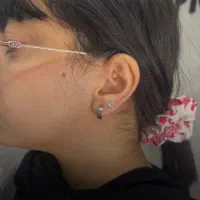 مرکزپیرسینگ/میکرودرمال/پانچ گوش/خال برداری