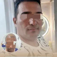 کاشت مو در شیراز+یک شب اقامت رایگان فقط ۱۶۹۰۰|خدمات آرایشگری و زیبایی|تهران, کوثر|دیوار