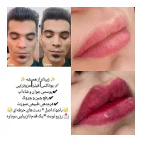 تزریق انواع ژل و بوتاکس|خدمات آرایشگری و زیبایی|شیراز, شهرک والفجر|دیوار