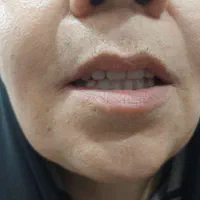 های دنت تخصصی ترین لابراتوار دندان مصنوعی(اقتصادی)|خدمات آرایشگری و زیبایی|گلستان (تهران), |دیوار