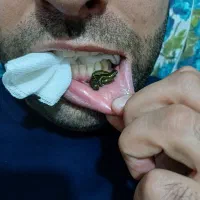 حجامت،زالو درمانی،نوین طب آریایی|خدمات آرایشگری و زیبایی|کرمانشاه, |دیوار