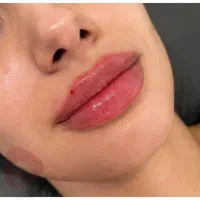 درمان و خدمات زیبایی|خدمات آرایشگری و زیبایی|فردیس, فردیس|دیوار