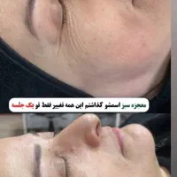 اموزش وخدمات تخصصی پوست باتخفیف بلک فرایدی