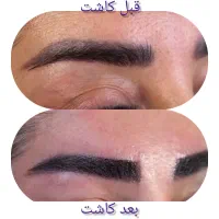 زیبایی ،پوست ،جراحی