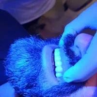 آموزش کامپوزیت دندان فقط ۱۵ میلیون تومان