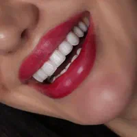 لمینت کامپوزیت ایمپلنت ارتودنسی عصب کشی|خدمات آرایشگری و زیبایی|شیراز, قصرالدشت|دیوار