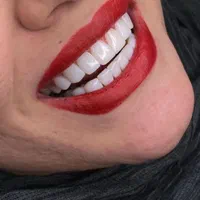 لبخند رویایی در جشنواره با تخفیف ویژه