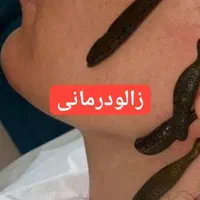 حجامت زالو سم زدایی شستشو گوش لاغری|خدمات آرایشگری و زیبایی|مشهد, شهید آوینی|دیوار
