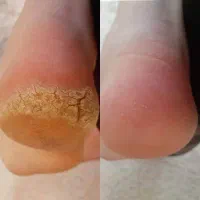 اصلاح ابرو وکس اپیلاسیون میکاپ پدیکور قائمیه|خدمات آرایشگری و زیبایی|اسلام‌شهر, شهرک قائمیه|دیوار