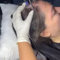 بوتاکس ژل مزوتراپی مو و صورت میکرونیدلینگ فشیال|خدمات آرایشگری و زیبایی|چهارباغ, |دیوار