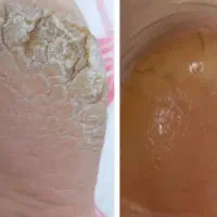 کفسابی پدیکور پا جوانسازی دست|خدمات آرایشگری و زیبایی|سبزوار, فرهنگیان|دیوار