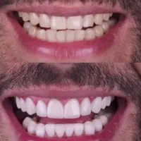 دندانپزشکی با تعرفه 1403|خدمات آرایشگری و زیبایی|اصفهان, باتون|دیوار