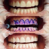 دندانپزشکی دنو اقساطی با چک یا سفته|خدمات زیبایی و سلامت|تهران, شهران شمالی|دیوار