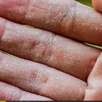 دعوت به مشاوره رایگان|آرایشی، بهداشتی، درمانی|شیراز, ابیوردی|دیوار
