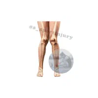 سوال درباره باشگاه حرکات اصلاحی