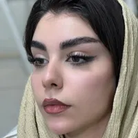 ژل بوتاکس عمل بینی ساکشن چربی در کلینیک بهنود|خدمات آرایشگری و زیبایی|تبریز, |دیوار