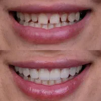 ارائه کلیه خدمات دندانپزشکی