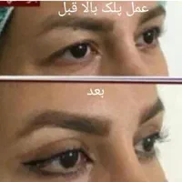 **جشنواره عمل زیبایی با قیمت‌های ویژه**|خدمات آرایشگری و زیبایی|شیراز, میرزاکوچک خان|دیوار