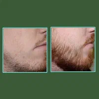 یه تغییر که دیده میشه|آرایشی، بهداشتی، درمانی|کرمانشاه, |دیوار