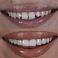 کلینیک دندانپزشکی سیوا|خدمات آرایشگری و زیبایی|نسیم‌شهر, |دیوار