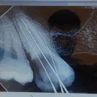 فروش رادیوگرافی سه بازو اصل فونا ایتالیا|پزشکی|بوکان, |دیوار