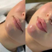 فقط تا پایان آبان