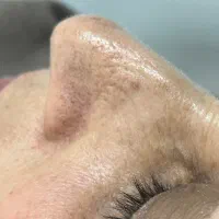 پاکسازی فقط۲۰۰وقتا داره پر میشه|خدمات آرایشگری و زیبایی|اردبیل, |دیوار