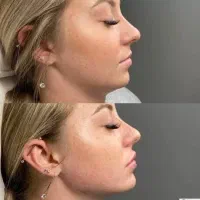 ژل و بوتاکس|خدمات آرایشگری و زیبایی|تهران, صادقیه|دیوار