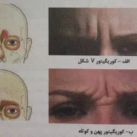 آموزش تزریق بوتاکس، فیلر، مزوتراپی