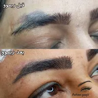 از شر تتوی قدیمیت خلاص شو|خدمات آرایشگری و زیبایی|تربت‌حیدریه, فرمانداری|دیوار