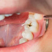 جشنواره دندانپزشکی اقساط دندان پزشکی همه خدمات|خدمات آرایشگری و زیبایی|اصفهان, دشتستان|دیوار
