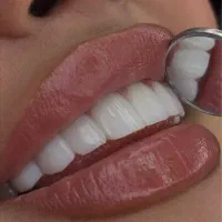 ایمپلنت کامپوزیت لمینت ارتو درمانی *اقساط بدون چک*